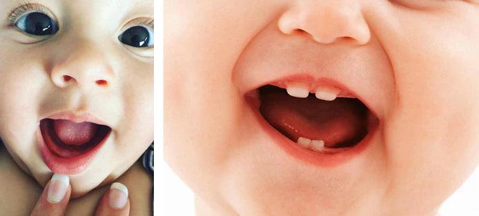 Do babies online start teething