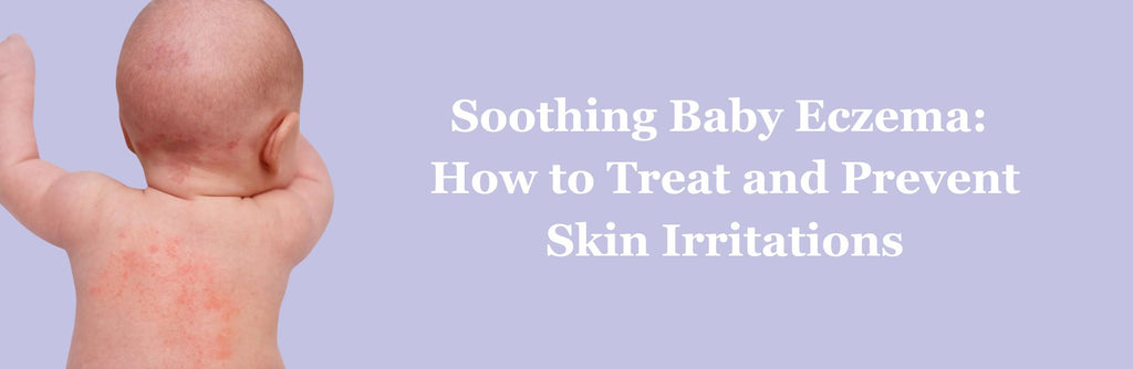 Soothing Relief: Top Tips for Treating Baby Eczema Flare-Ups