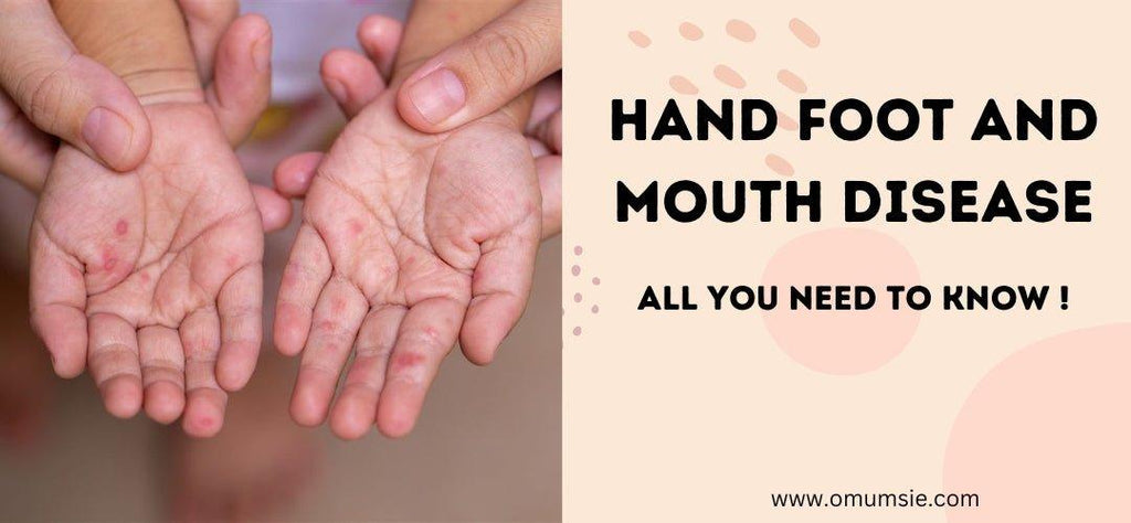 Guide to Hand foot and mouth disease in kids - omumsie