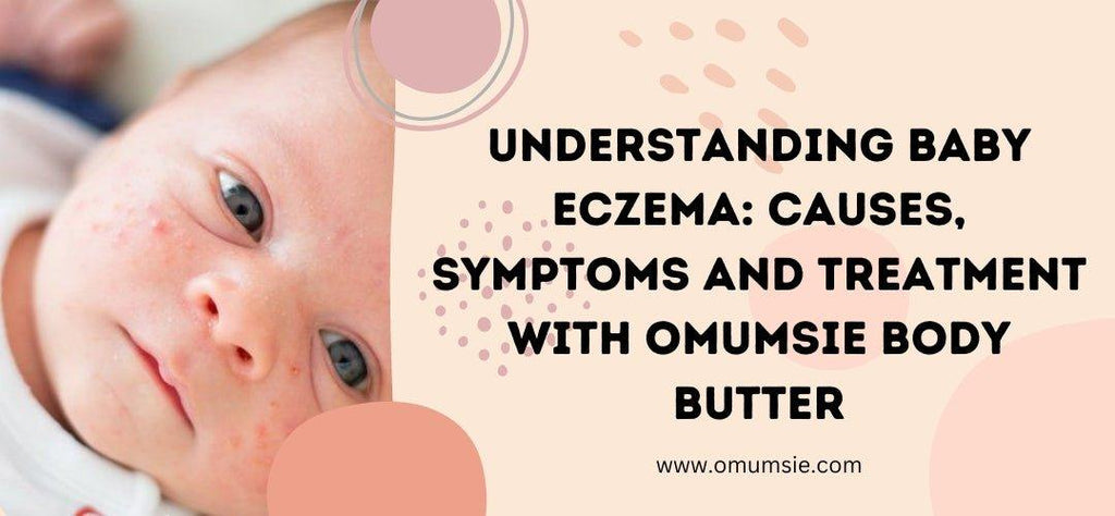 Understanding Baby Eczema: Causes, Symptoms, and Treatment with Omumsie Baby Butter and Body Wash - omumsie